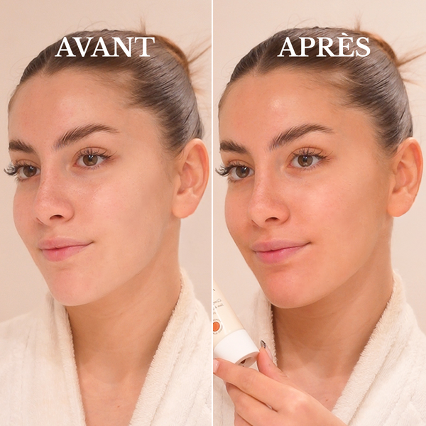 Avant / Après Angélique L.