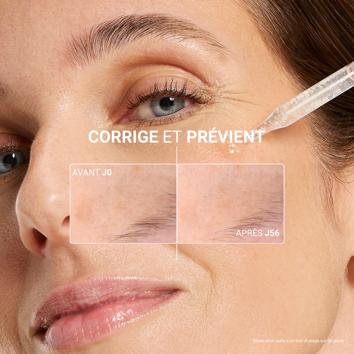 Routine Anti-Taches